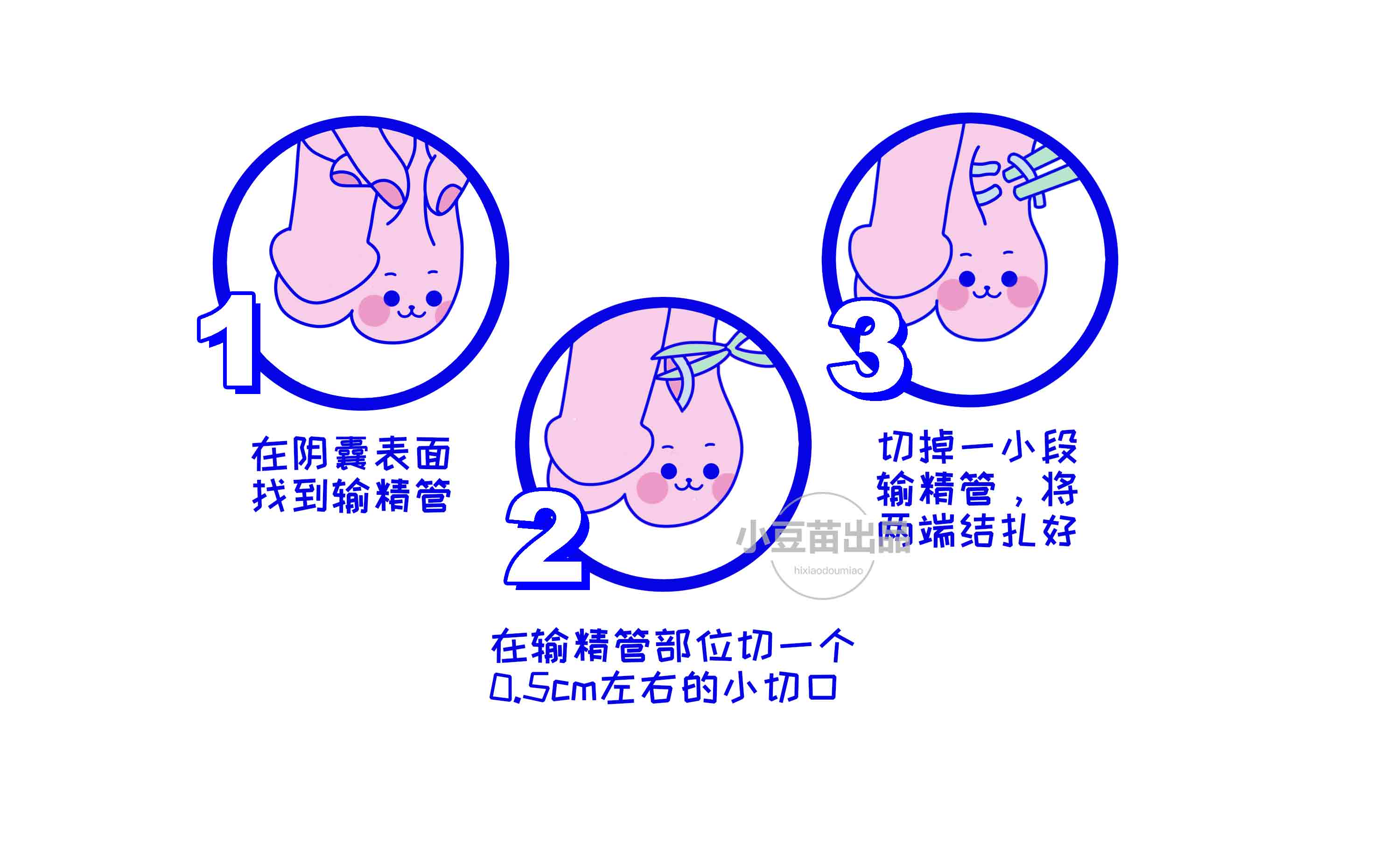 哪一周借卵做试管供卵三代剖腹产比较好,剖腹产可以借卵做供卵自怀试管吗