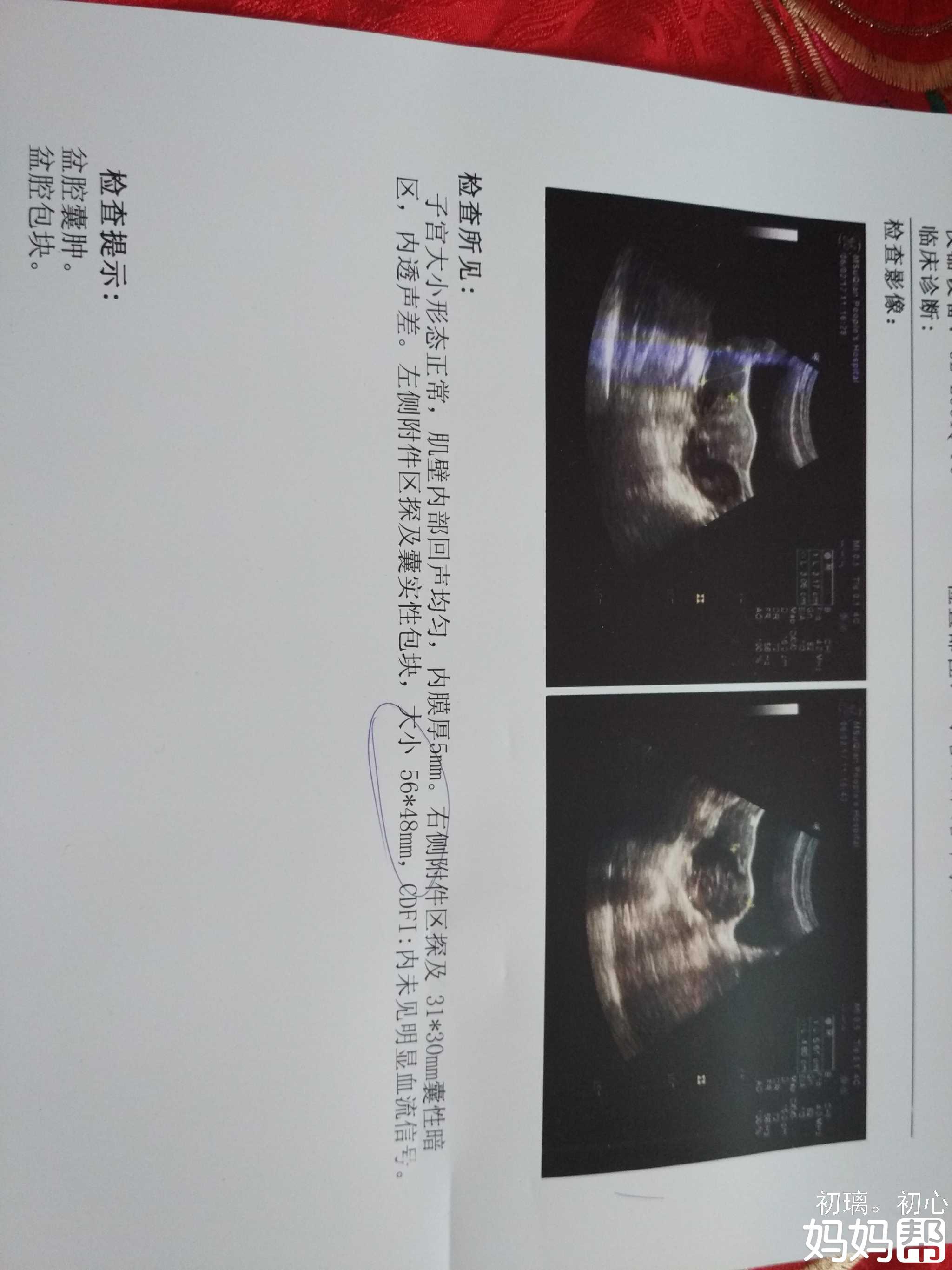 在中信湘雅借卵做试管进入周期打降调后是不是就快了