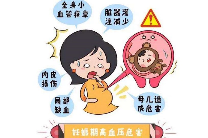 23+2，胎儿右心室发育不良