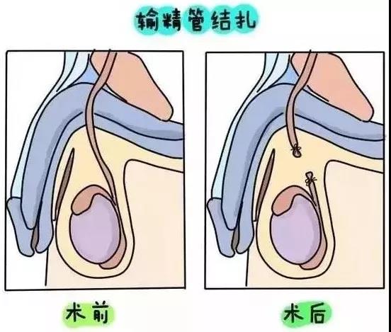 做供卵试管建档是干嘛