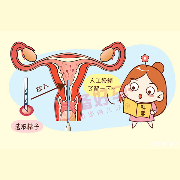 做借卵试管怀孕后要做无创吗