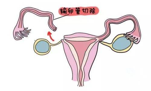 试管卵巢功能不好用什么方案