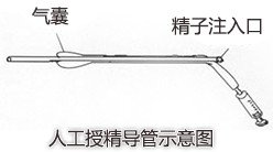 试管婴儿一年多少钱