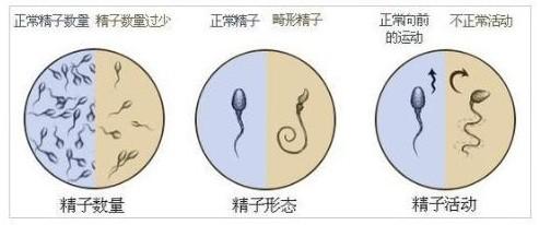 试管婴儿第一次宫外孕,第二次成功几率