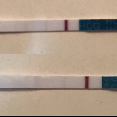 女性35岁试管成功率