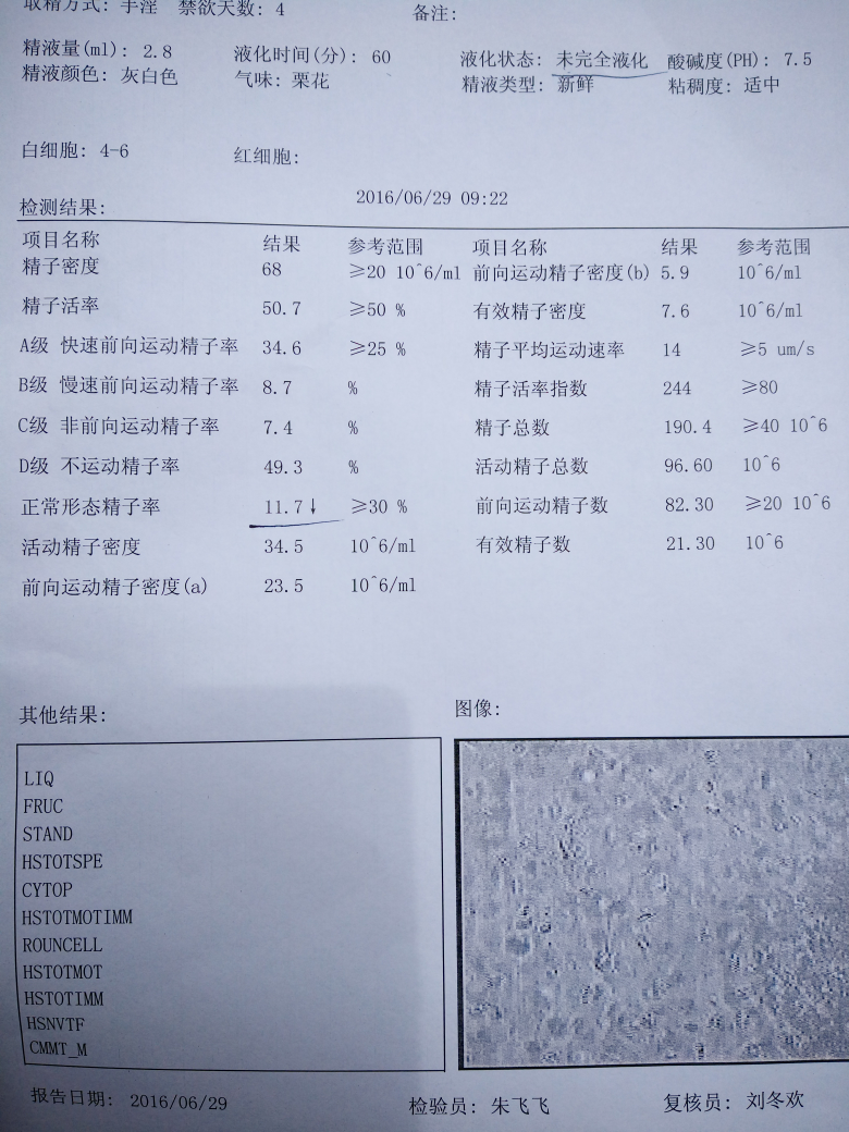 染色体45x可不可以生育45X嵌合体染色体能不能自怀