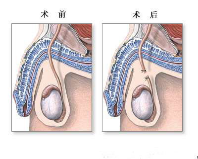赣南医学院第一附属医院人工授精+有做试管代怀的医院吗婴儿怎么样_第三代女性试管代怀多少费用