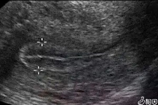 南昌代生男孩违法吗婴儿费用是多少钱（中介价格69044元）